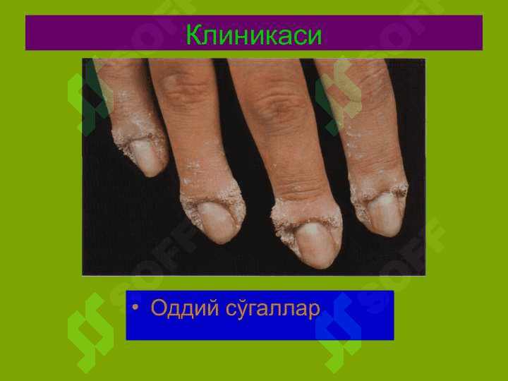 Терининг вирусли касалликлари 7