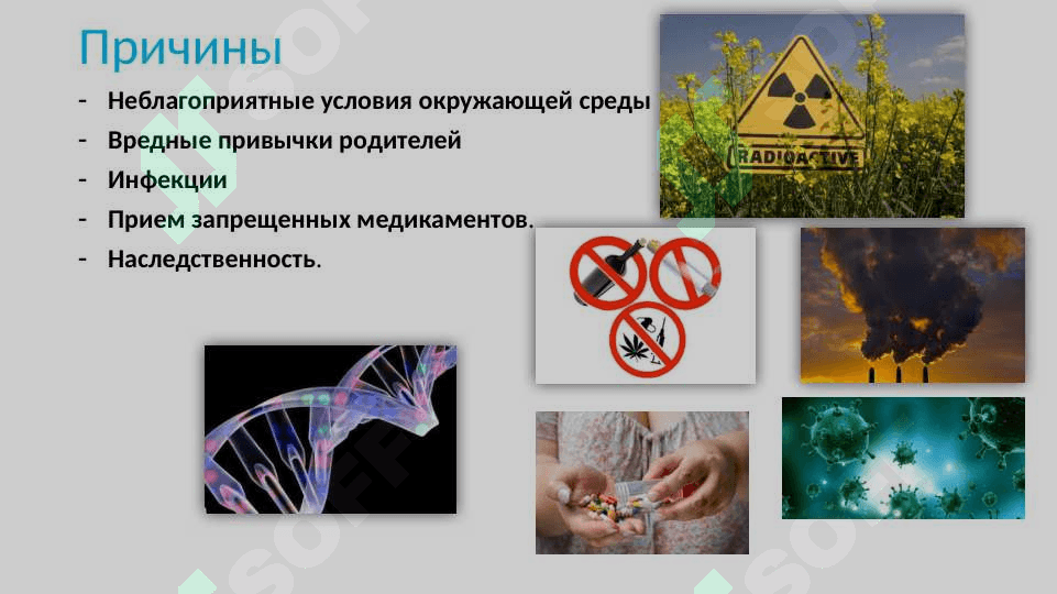 Аномалии развития селезенки 3
