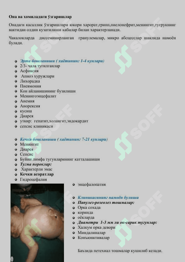 Хомиланинг иммун химояси 2