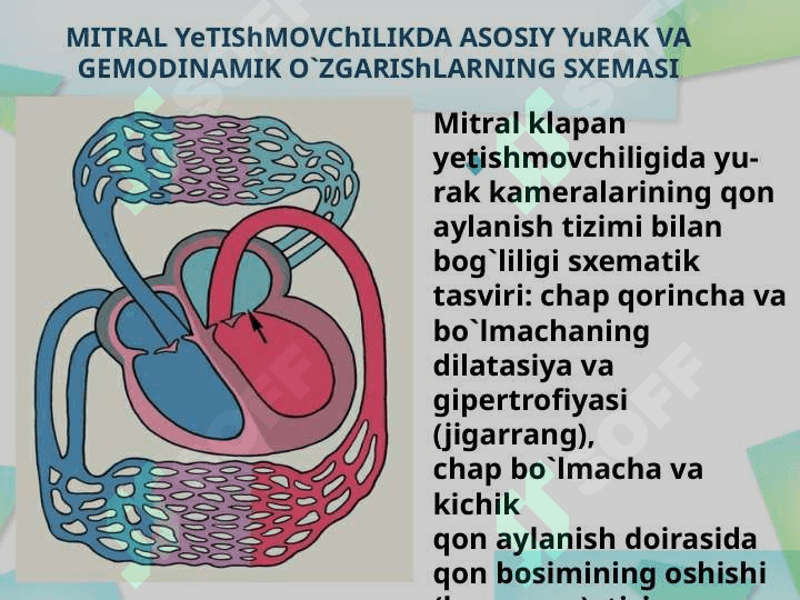 YURAKNING AORTAL NUQSONLARI 7