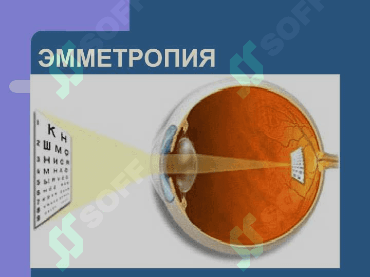Refraksiya va akkomodatsiya.ppt 6