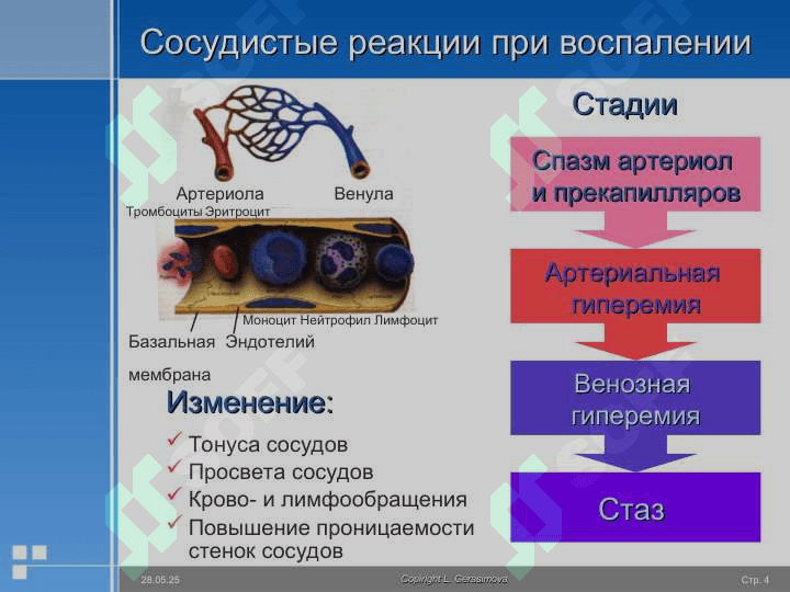 Воспаление 4