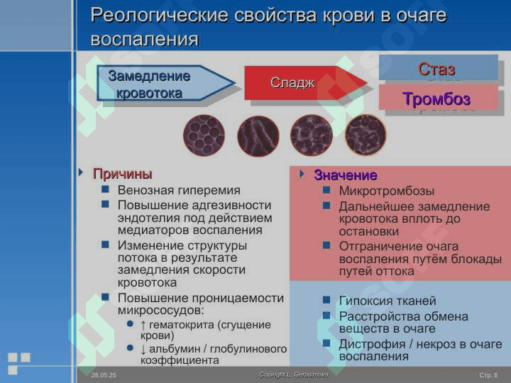 Воспаление 8