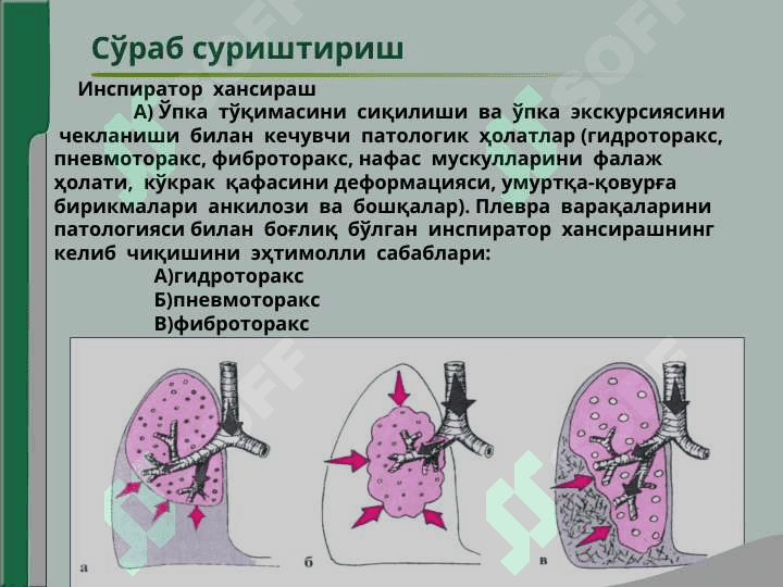 Нафас аъзолари  касалликлари  билан  касалланган  беморларни  текшириш.Сўраб- суриштириш, кўздан  кечириш.Кўкрак  қафасини  пальпацияси.Ўпка  перкуссияси.Ўпка аускультацияси 4