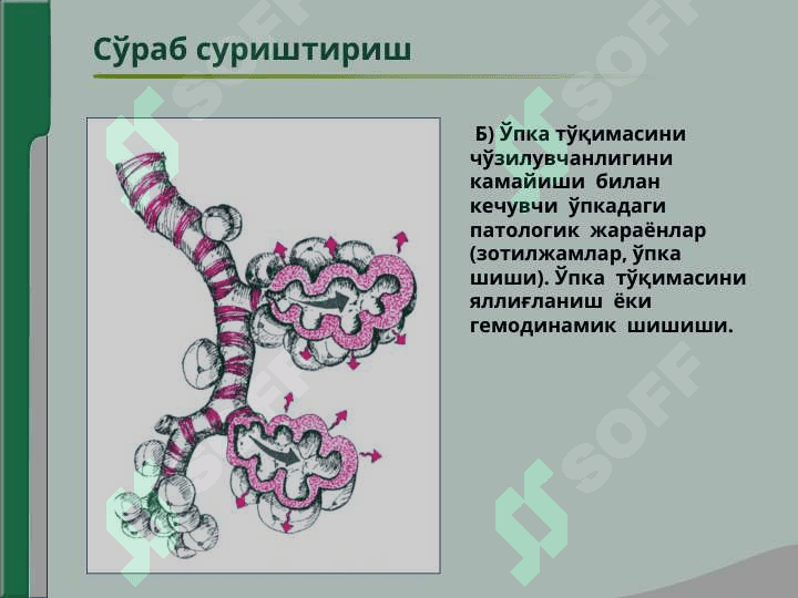 Нафас аъзолари  касалликлари  билан  касалланган  беморларни  текшириш.Сўраб- суриштириш, кўздан  кечириш.Кўкрак  қафасини  пальпацияси.Ўпка  перкуссияси.Ўпка аускультацияси 5
