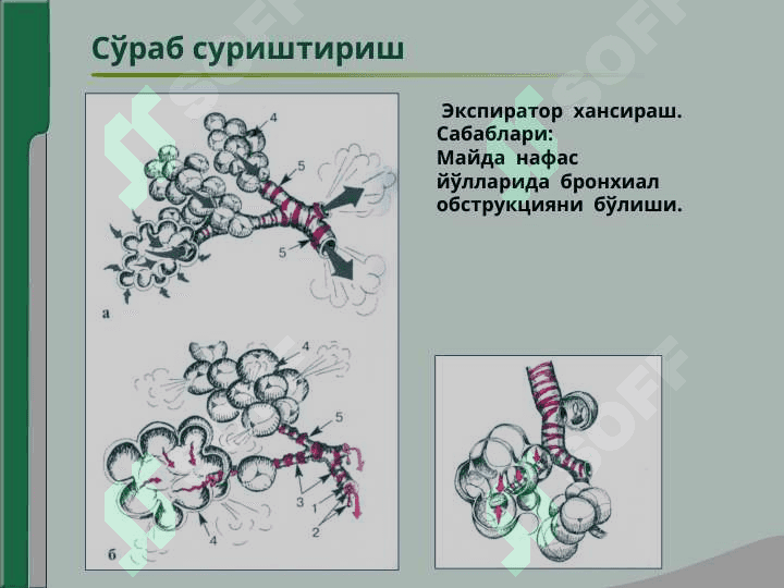 Нафас аъзолари  касалликлари  билан  касалланган  беморларни  текшириш.Сўраб- суриштириш, кўздан  кечириш.Кўкрак  қафасини  пальпацияси.Ўпка  перкуссияси.Ўпка аускультацияси 6