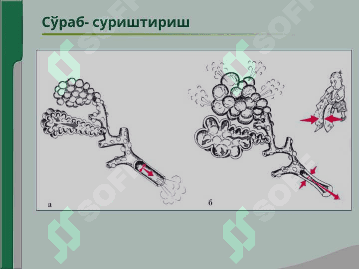 Нафас аъзолари  касалликлари  билан  касалланган  беморларни  текшириш.Сўраб- суриштириш, кўздан  кечириш.Кўкрак  қафасини  пальпацияси.Ўпка  перкуссияси.Ўпка аускультацияси 7