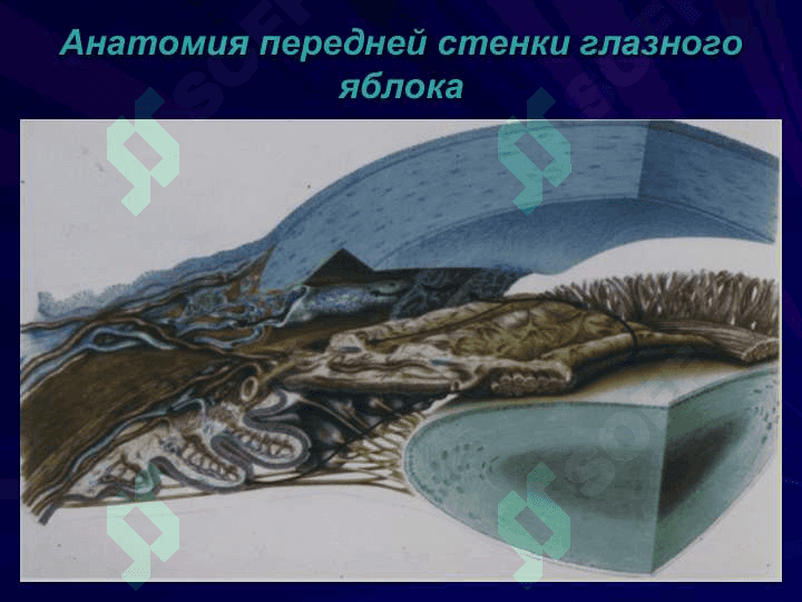 Глаукома 2