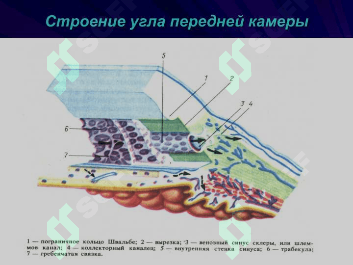 Глаукома 3