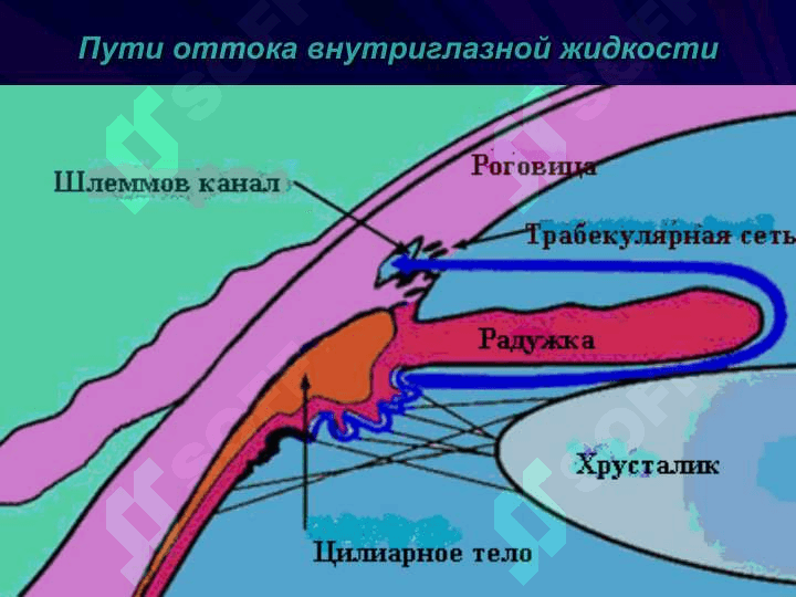 Глаукома 4