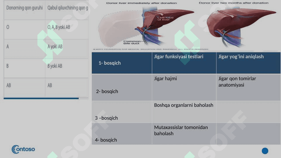 Jigar transplantatsiyasi. 8