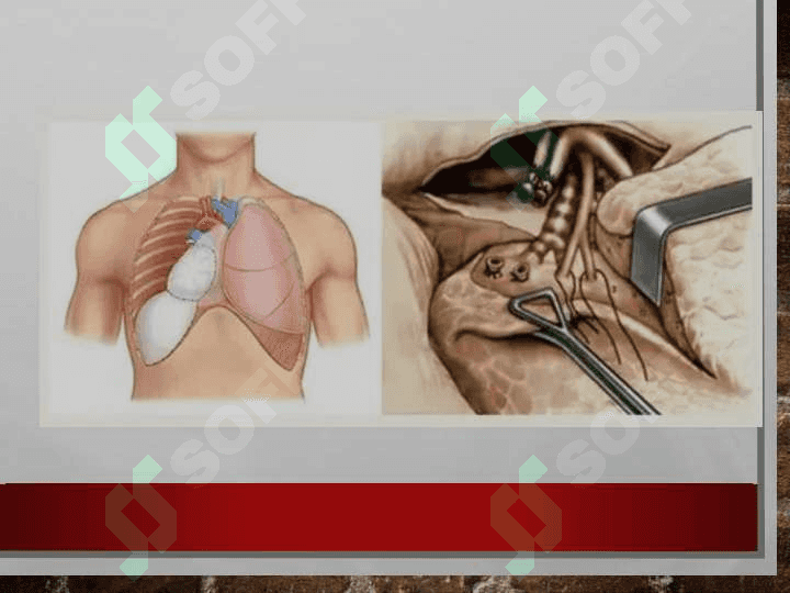 O’pka transplantatsiyasi 5