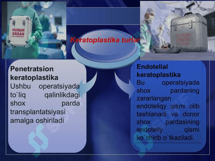 Shox parda transplantatsiyasi 7