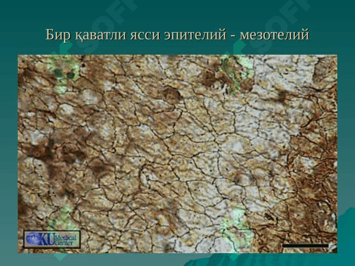ЭПИТЕЛИЙ ТЎҚИМАСИ 3