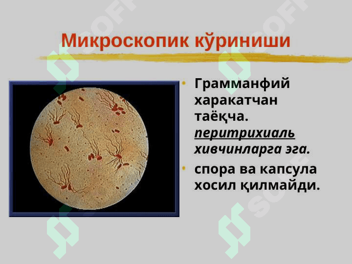 Ич терлама – қорин тифи (Typhus abdominalis) 6