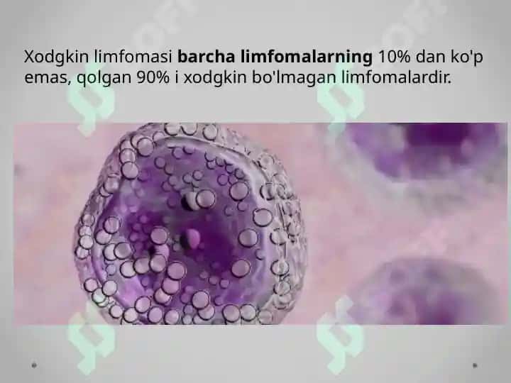 Nexodjkin limfomasi 5