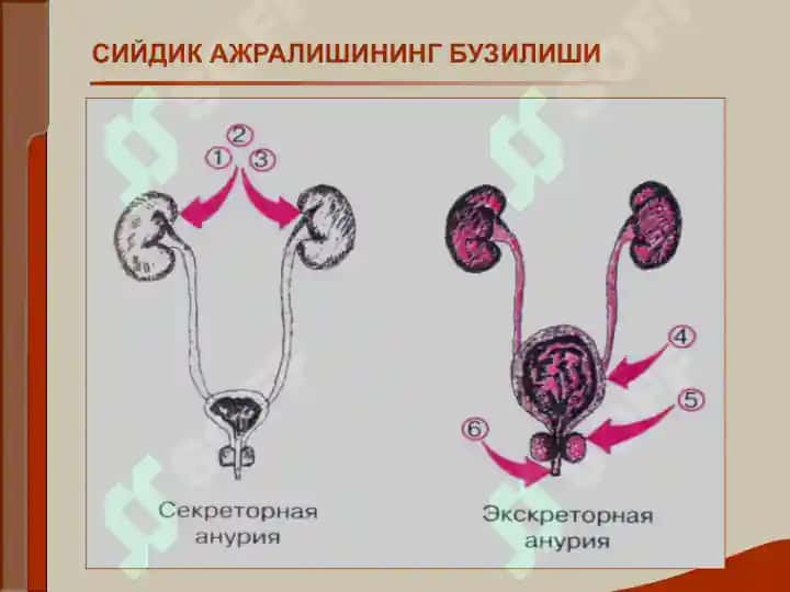 Буёрак касаллиги билан ўғриган беморларни текшириш 8
