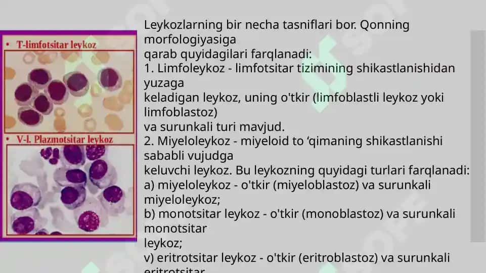 Oʻtkir va surunkali leykoz diagnostikasi 4