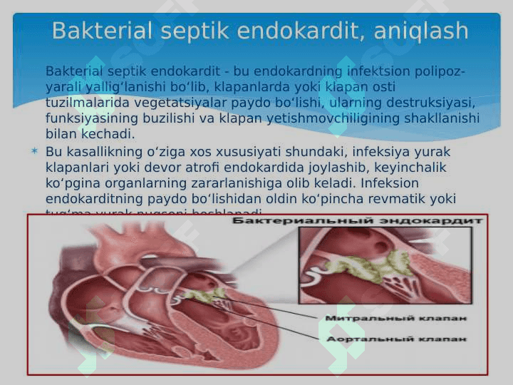 Septik endokardit simtomatologiyasi 2
