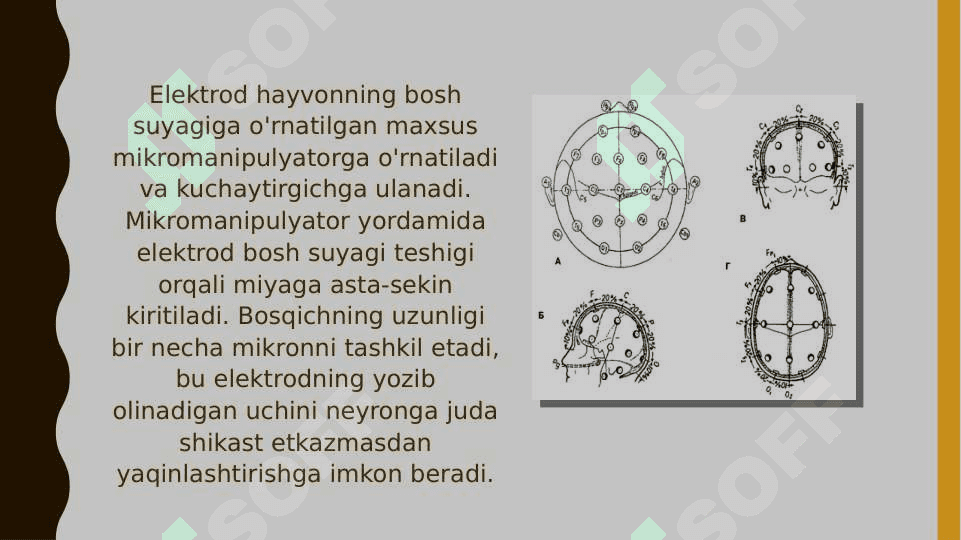 Impulsli faoliyatni qayd etish. Elektroensefalografiya 5