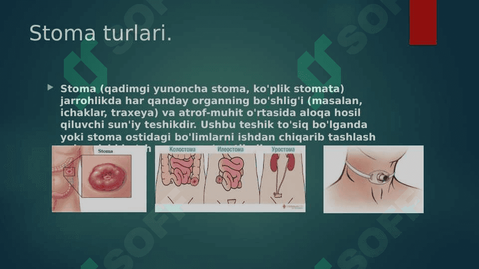 XIRURGIK STOMANI PARVARISH QILISH 3