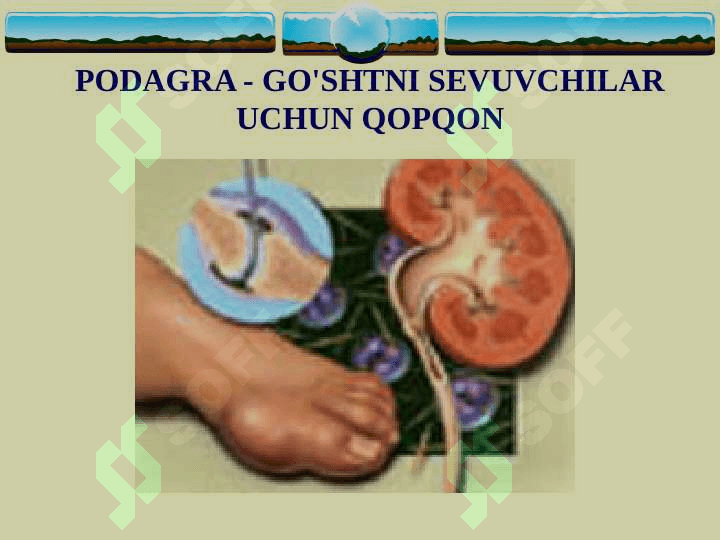 Podagra 3