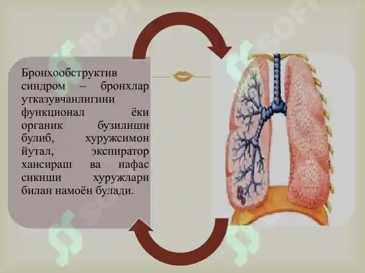 БРОНХООБСТРУКТИВ СИНДРОМҚИЕСИЙ ТАШХИСИ.УАШ ТАКТИКАСИ 4