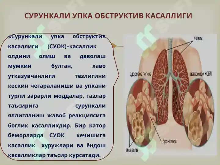 БРОНХООБСТРУКТИВ СИНДРОМҚИЕСИЙ ТАШХИСИ.УАШ ТАКТИКАСИ 7