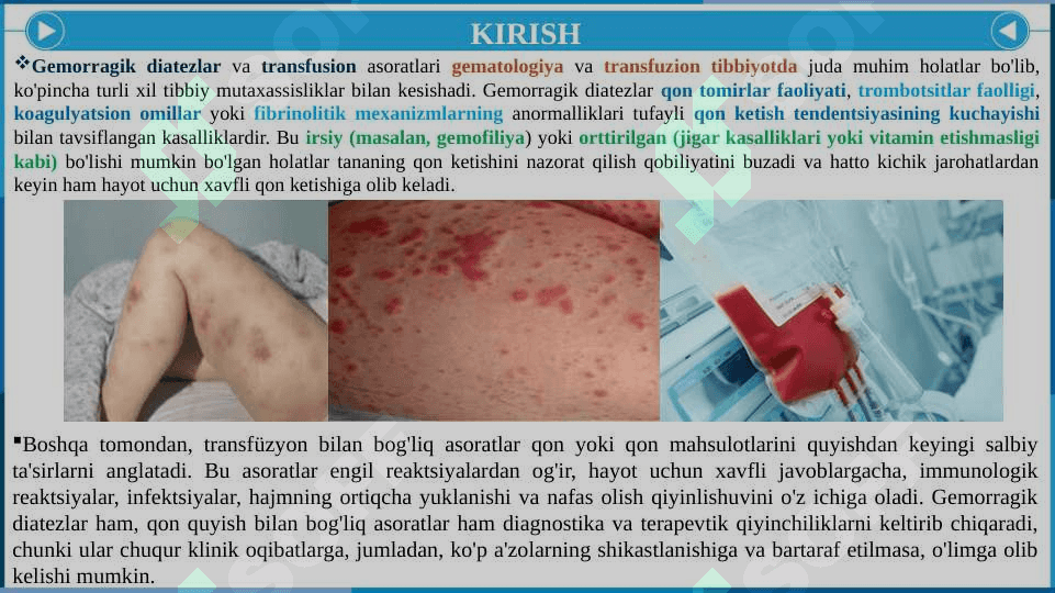 Gemorragik diatezlar. Trasfuzion asoratlar 3