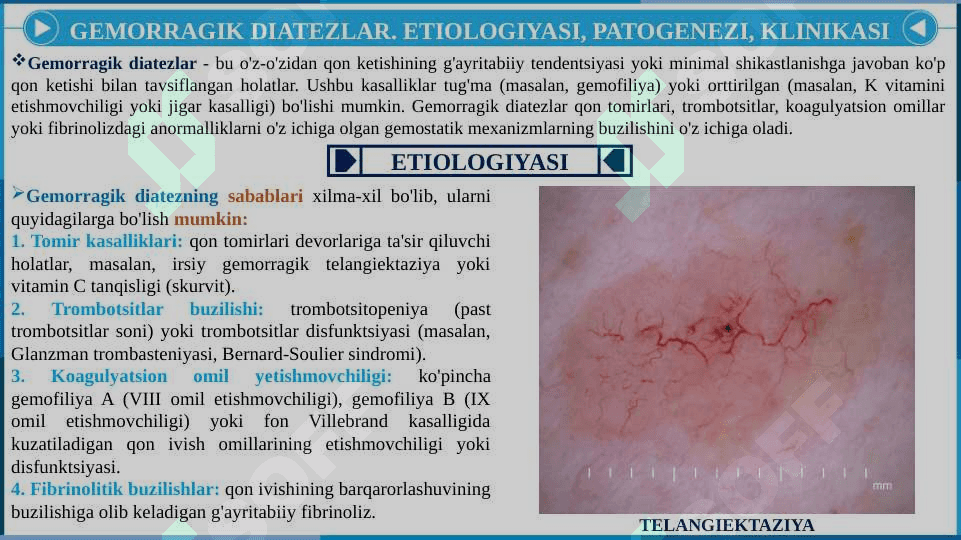 Gemorragik diatezlar. Trasfuzion asoratlar 5