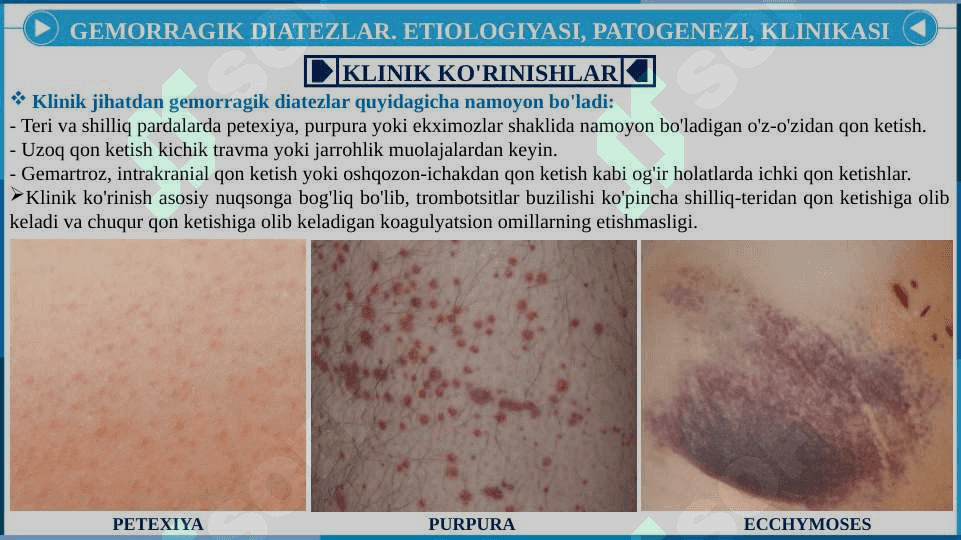 Gemorragik diatezlar. Trasfuzion asoratlar 8