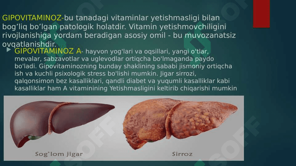 BOLALARDA GIPERVITAMINOZ VA GIPOVITAMINOZ 2