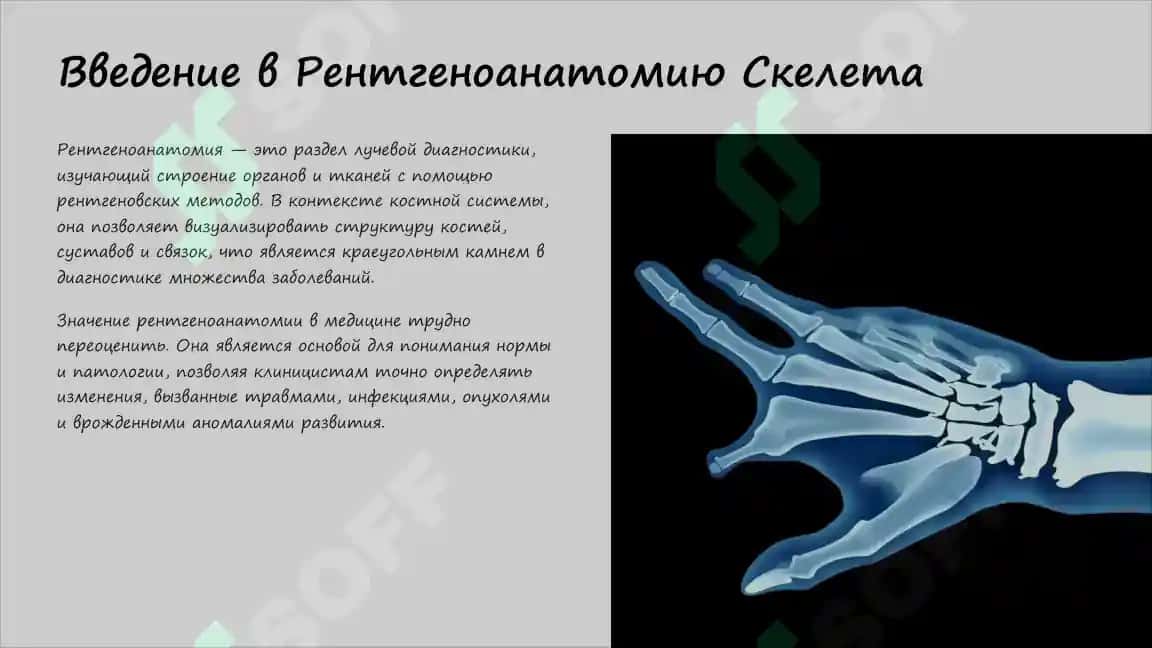 Рентгеноанатомия костей скелета: Норма и Аномалии Развития 2