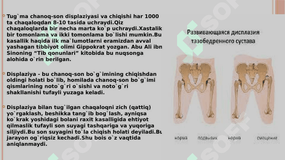 Chanoq-son bo’g’imi displaziyasi. Etiopatogenezi. Klinikasi. Tashxisot. Davolash 2