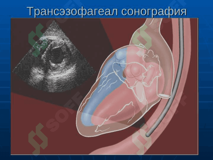 Юрак ва кон-томир касалликларининг нур ташхиси 8