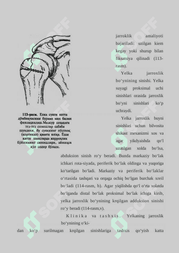 YELKANING SHIKASTLANISHI 4