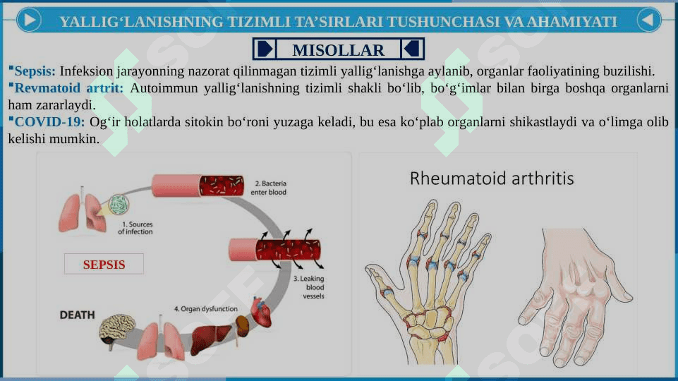 Yallig'lanishni tizimli tasirlari. Etipatogenezi va morfologiyasi. 8