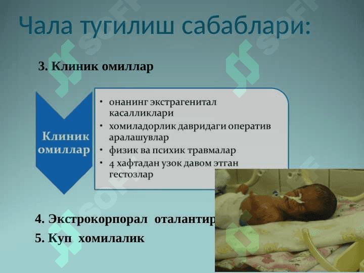 Чала тугилган чакалоклар 8