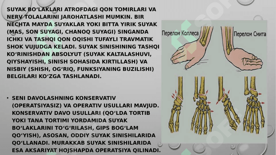 Suyaklar singanda birinchi yordam 4
