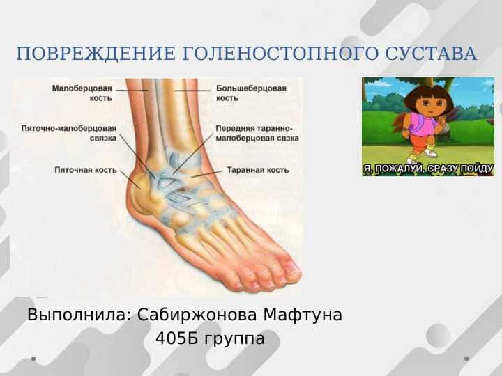 ПОВРЕЖДЕНИЕ ГОЛЕНОСТОПНОГО СУСТАВА 1