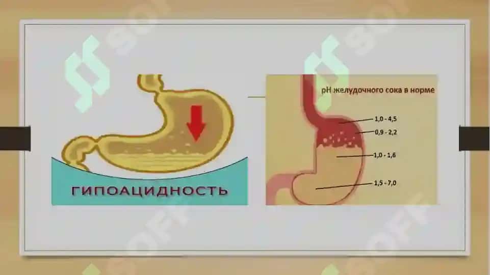 Gastrit 4