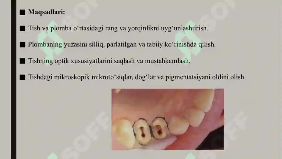 Doimiy plombalarga birlamchi pardoz berish 7