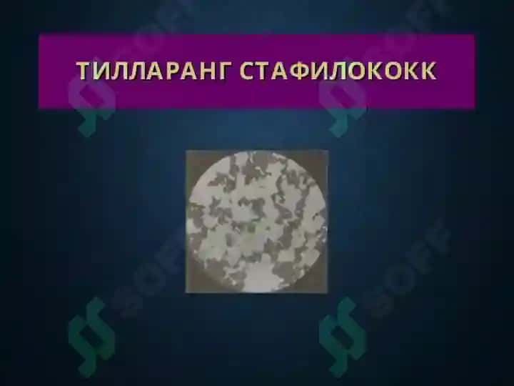 Терининг йирингли касалликлари 6