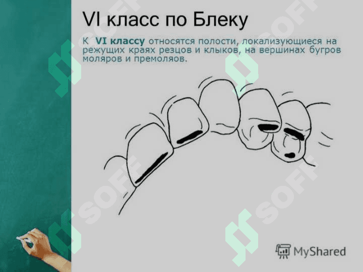 6-sinf karies kovakni charxlashning o'ziga xos tomonlari. 6