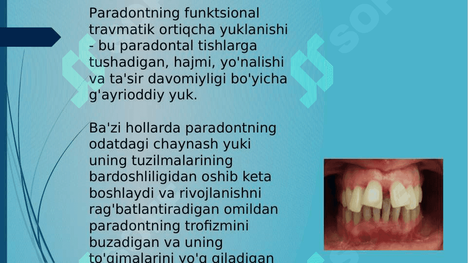 Paradont to'qimasining travmatik zo'riqishi 2