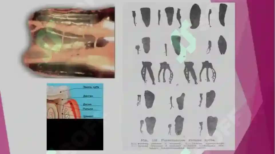 pulpitlarni tashxislash va davolash 4