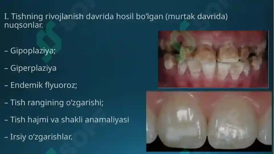 Tish toj qismining qisman yo’qotilishi 3