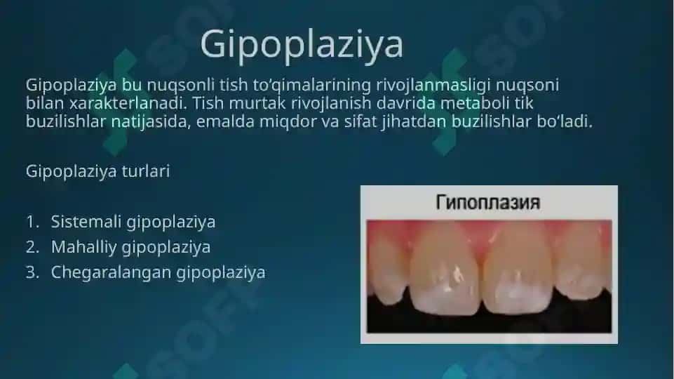 Tish toj qismining qisman yo’qotilishi 6