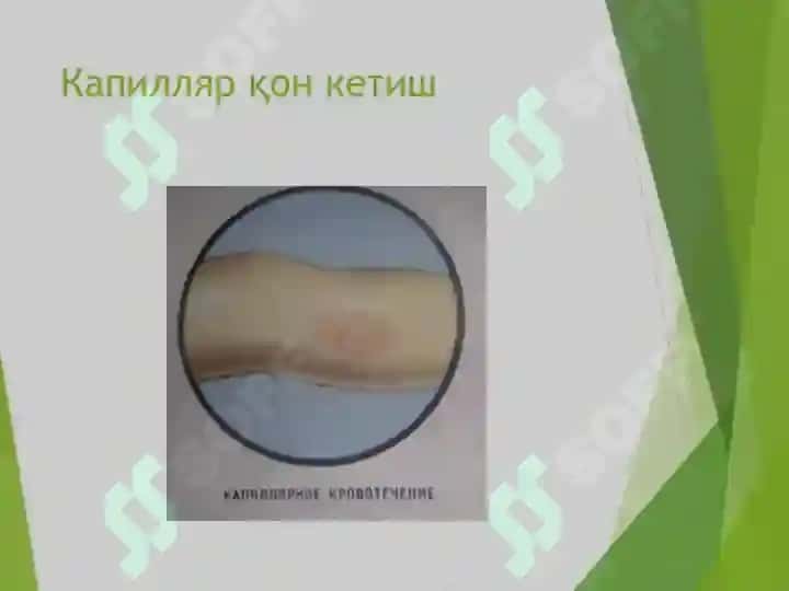 Қон кетиш 7
