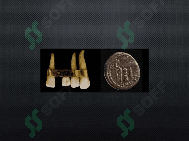 Dental implantatsiyaga kirish, implantatsiya tarixi. Dental implantatsiya tarixi, dental implantatsiyaning O'zbekistonda rivojlanishi, Dental implantatsiyani         rivojlanishiga hissa qo'shgan olimlar. 4